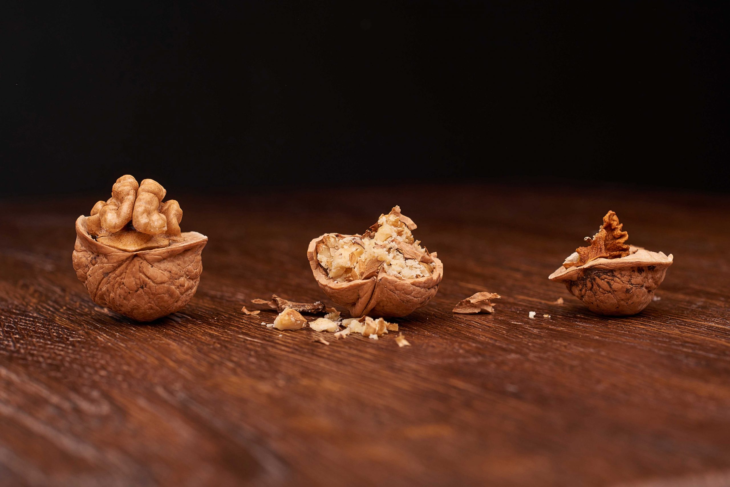 3 Myths about Young Onset Dementia Debunked